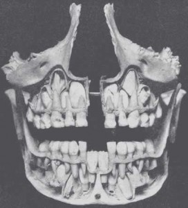 Teeth, Gray's Anatomy